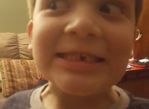 Toothless